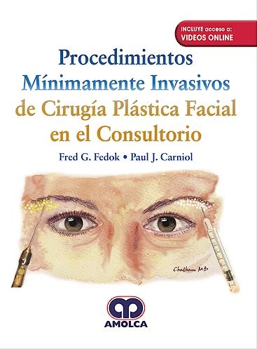 Procedimientos Mínimamente Invasivos de Cirugía Plástica Facial en el Consultorio