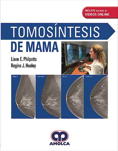 Tomosíntesis de Mama