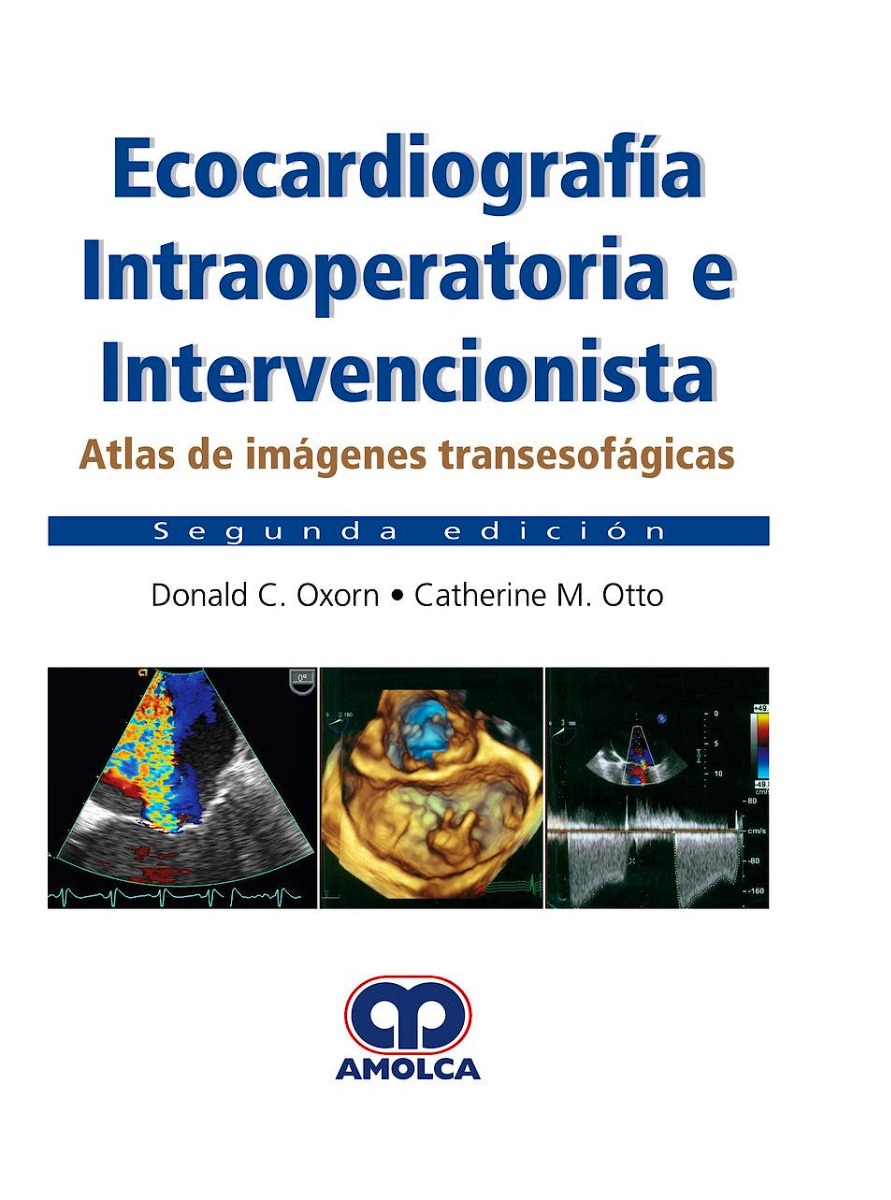 Ecocardiografía Intraoperatoria e Intervencionista. Atlas de Imágenes Transesofágicas