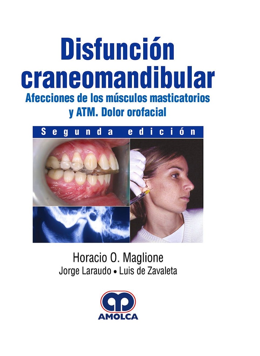 Disfunción Craneomandibular