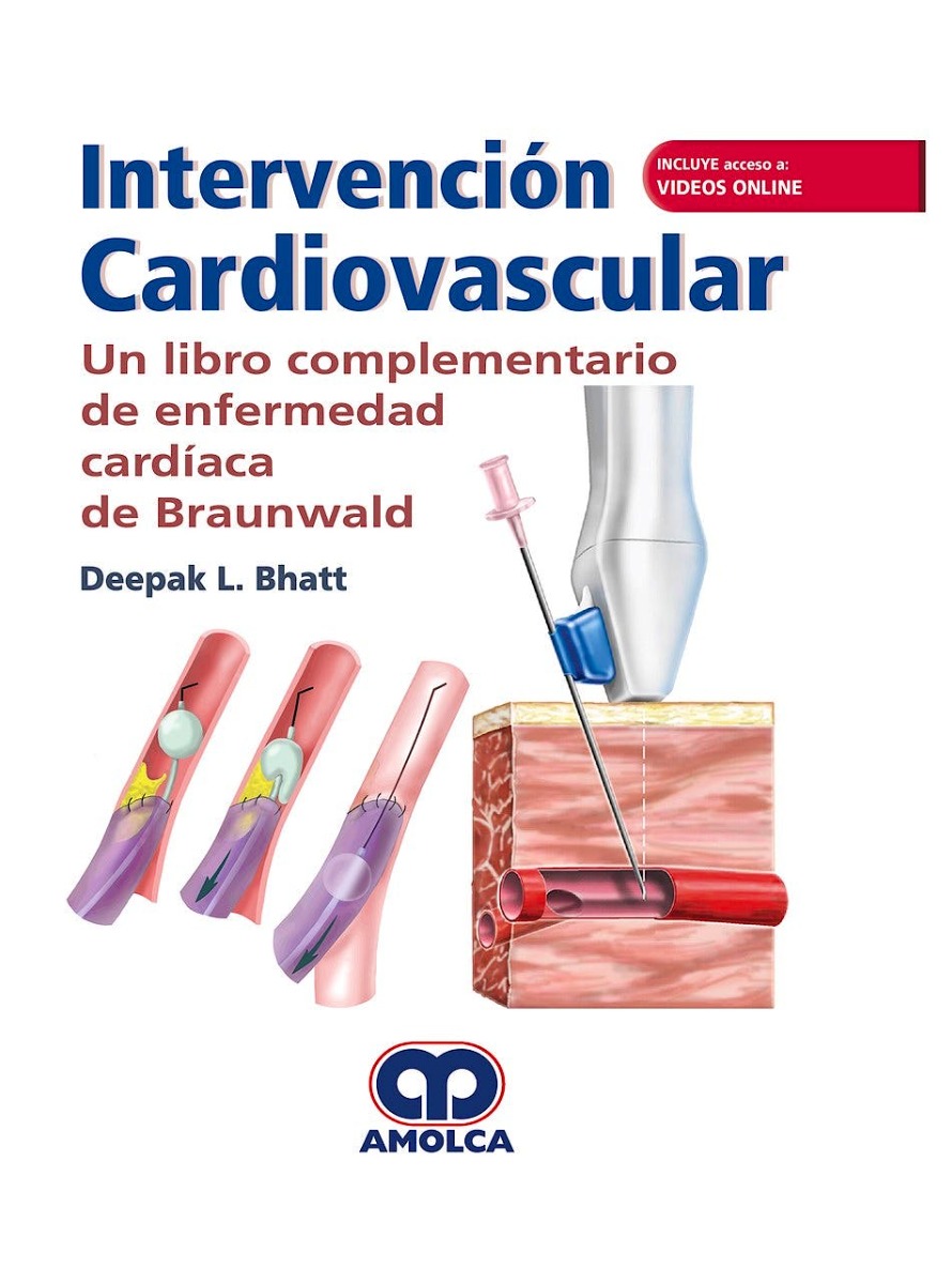 Intervención Cardiovascular