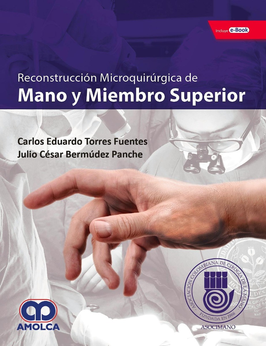 Reconstrucción Microquirúrgica de Mano y Miembro superior