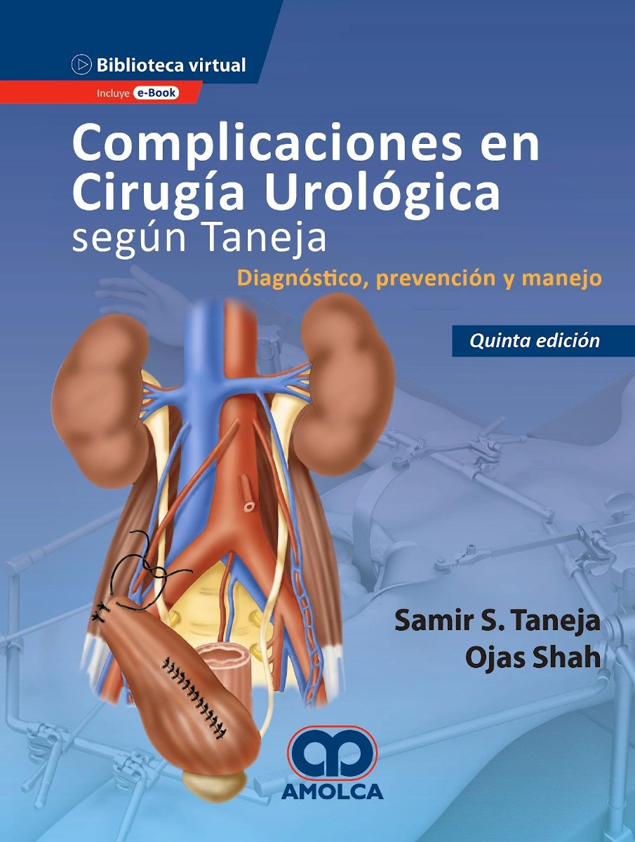 Complicaciones en Cirugía Urológica según Taneja