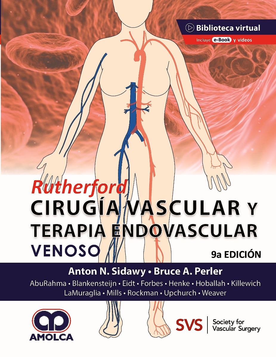 RUTHERFORD Cirugía Vascular y Terapia Endovascular: Venoso