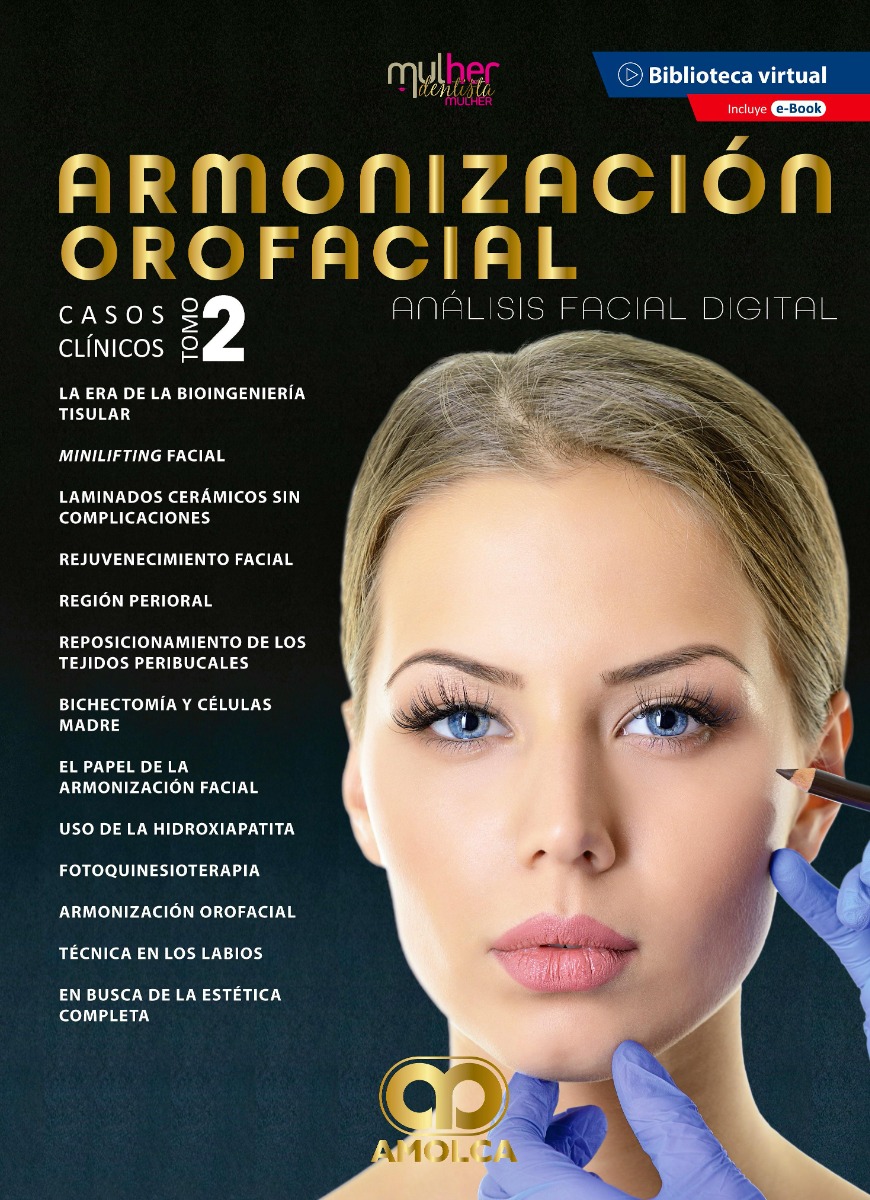 Armonización Orofacial. Análisis Facial Digital. Casos clínicos. Tomo 2