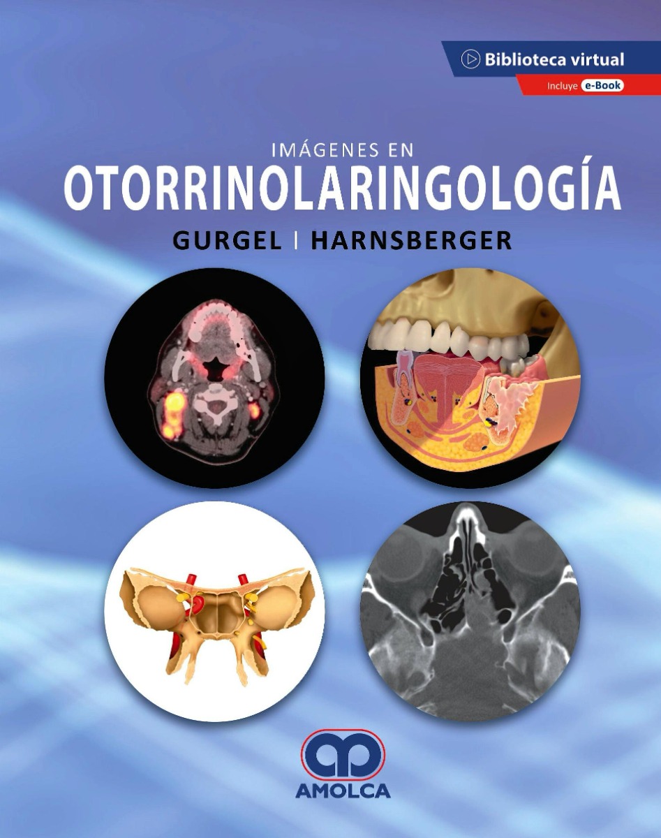 Imágenes en Otorrinolaringología