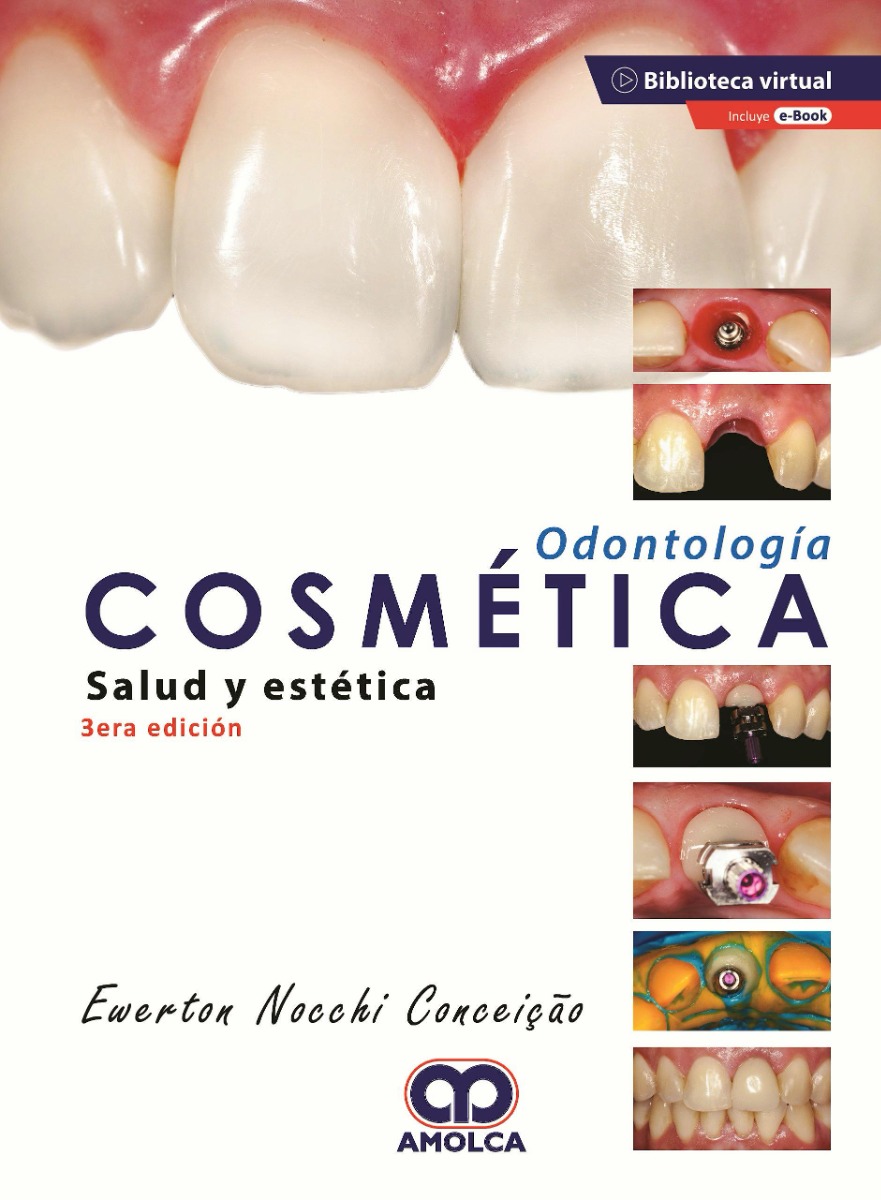 Odontología Cosmética