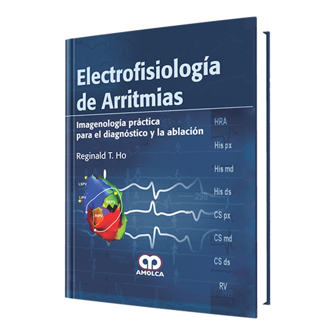 Electrofisiología de Arritmias