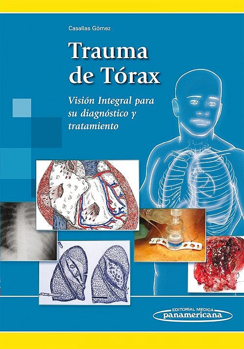 Trauma De Tórax Visión Integral Para Su Diagnóstico Y Tratamiento