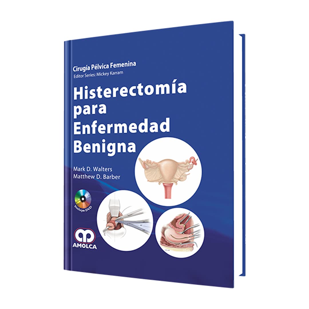 Histerectomía para Enfermedad Benigna