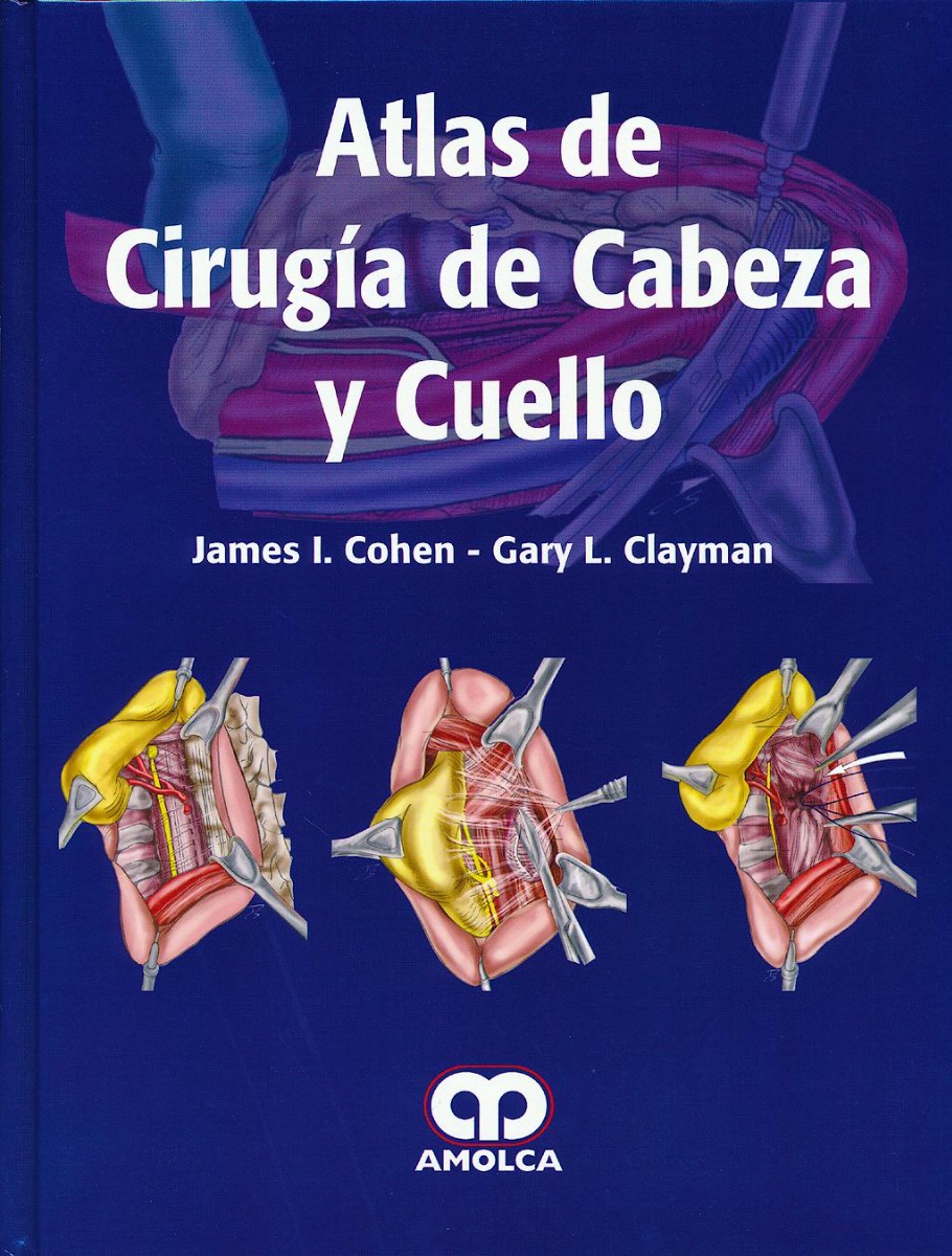 Atlas de Cirugía de Cabeza y Cuello