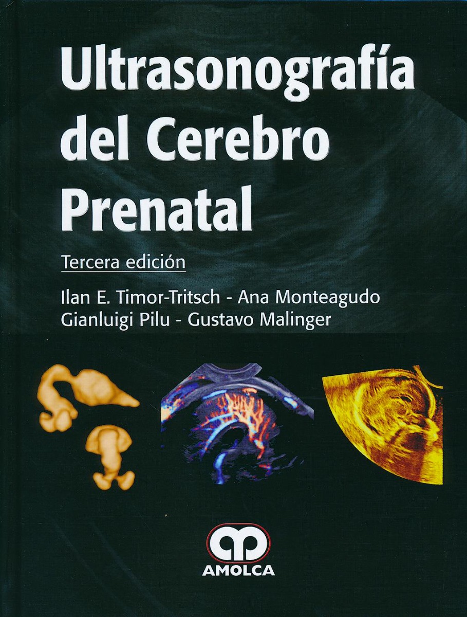 Ultrasonografía del Cerebro Prenatal