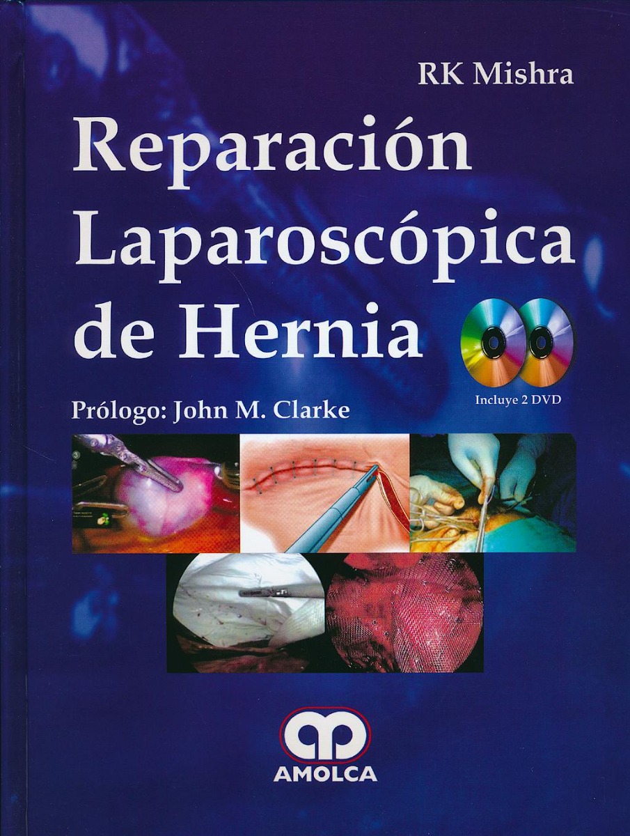 Reparación Laparoscópica de Hernia