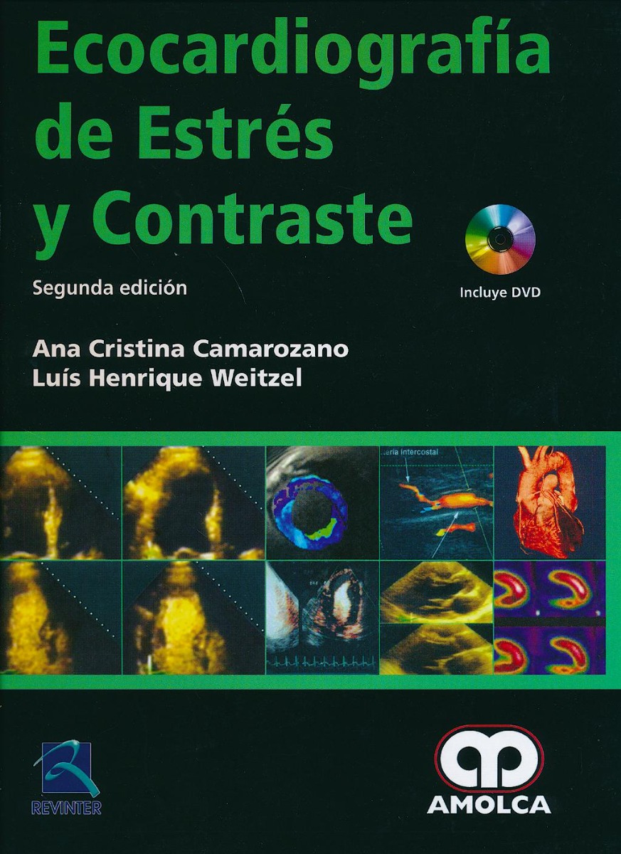 Ecocardiografía de Estrés y Contraste