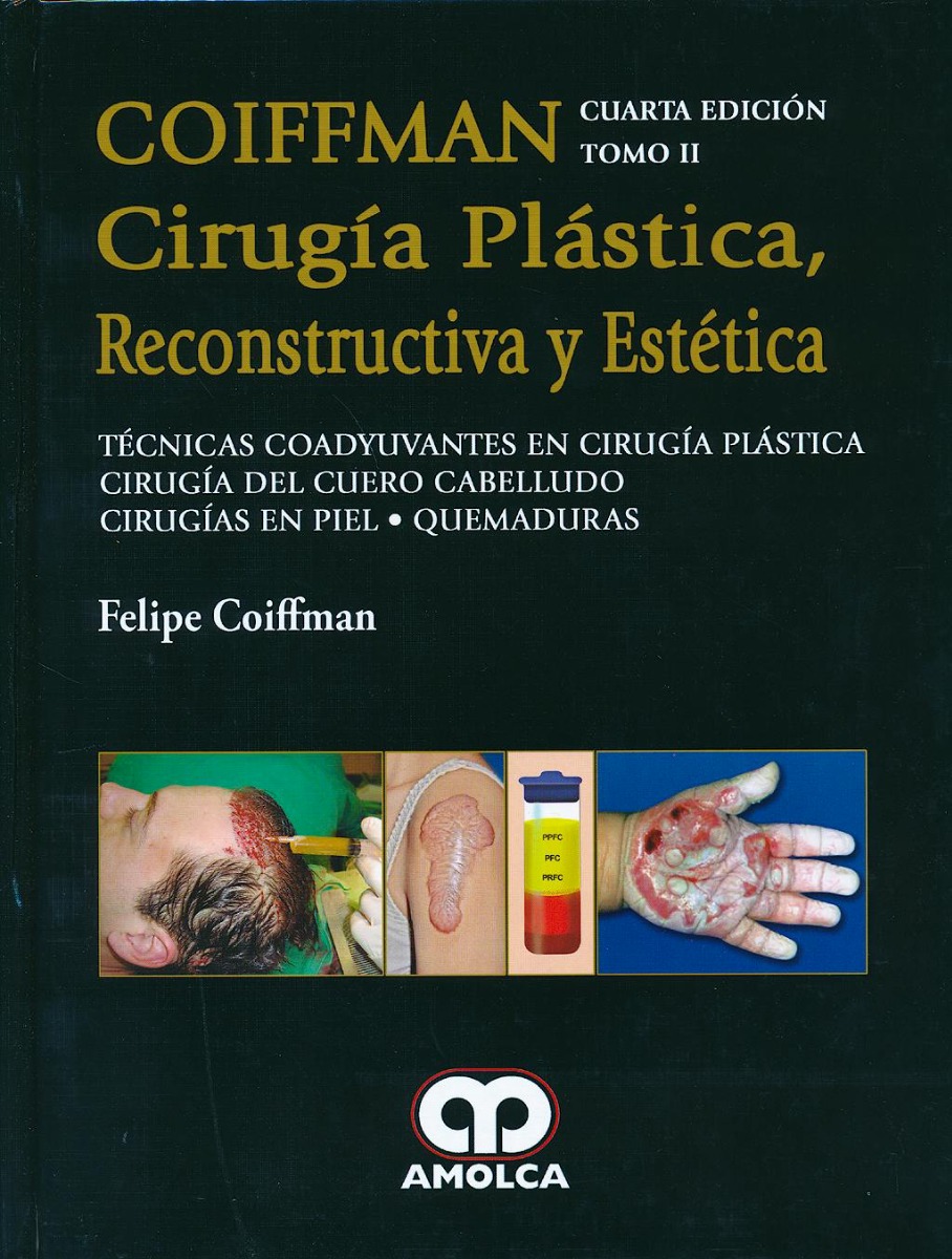 Coiffman Cirugía Plástica, Reconstructiva y Estética, Tomo II