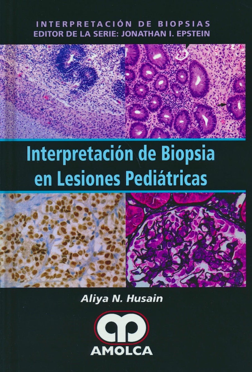 Interpretación de Biopsia en Lesiones Pediátricas