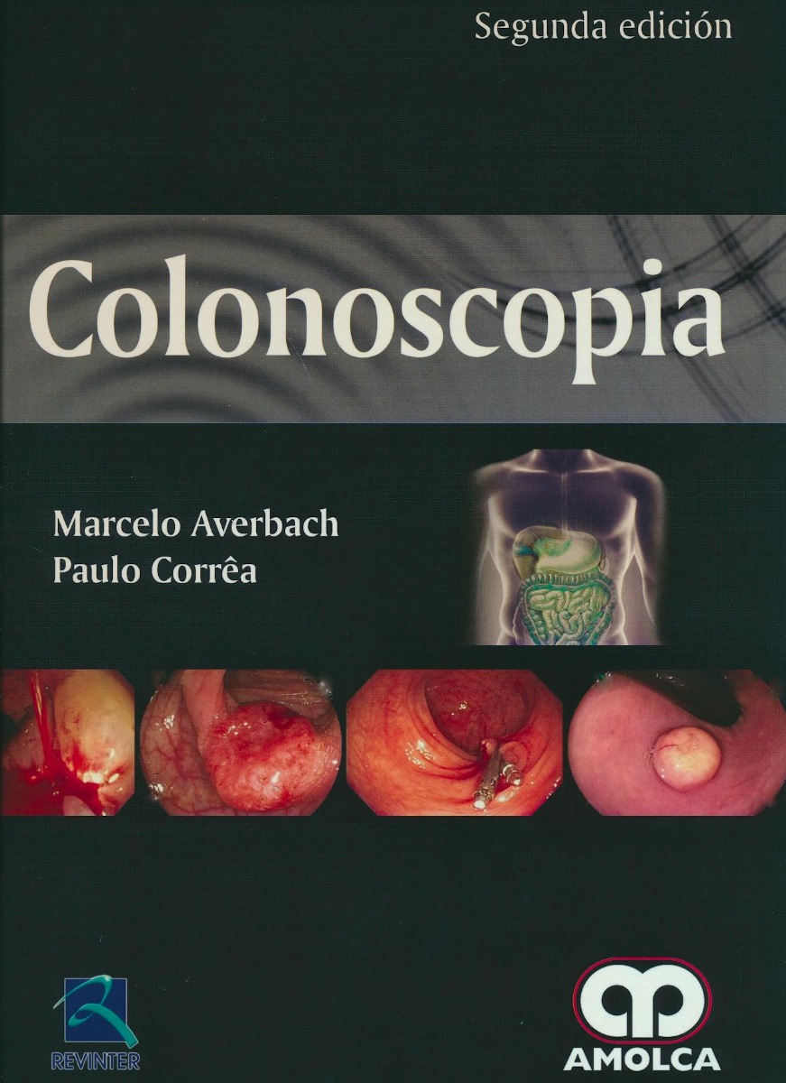 Colonoscopia