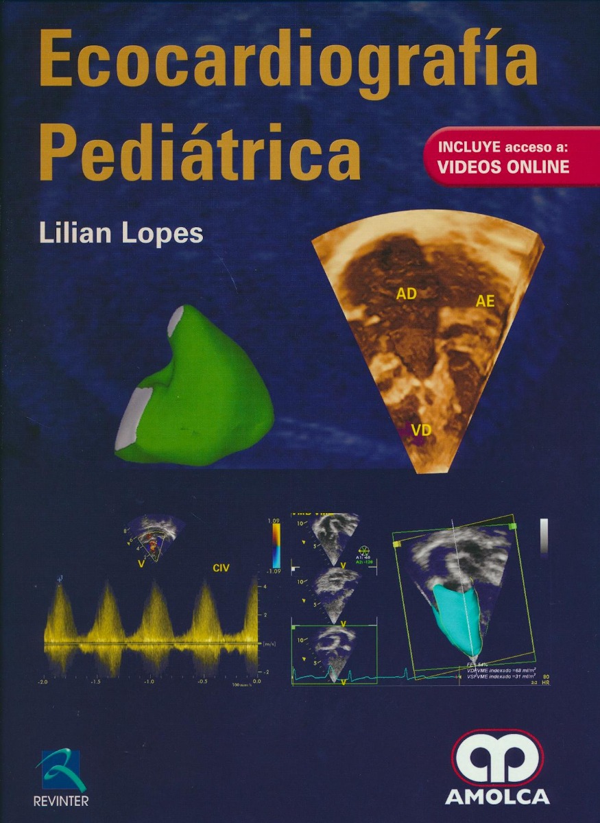 Ecocardiografía Pediátrica