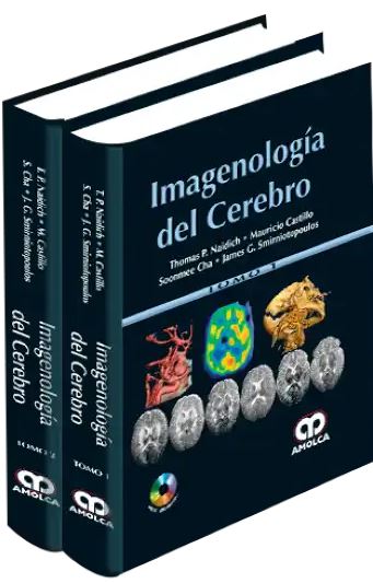 Imagenología del Cerebro, 2 Vols.