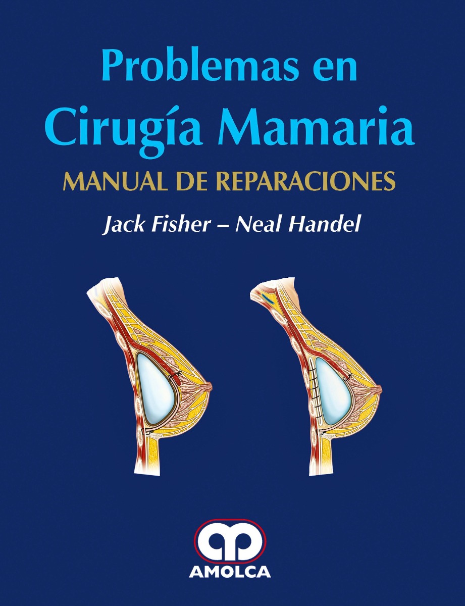 Problemas en Cirugía Mamaria. Manual de Reparaciones