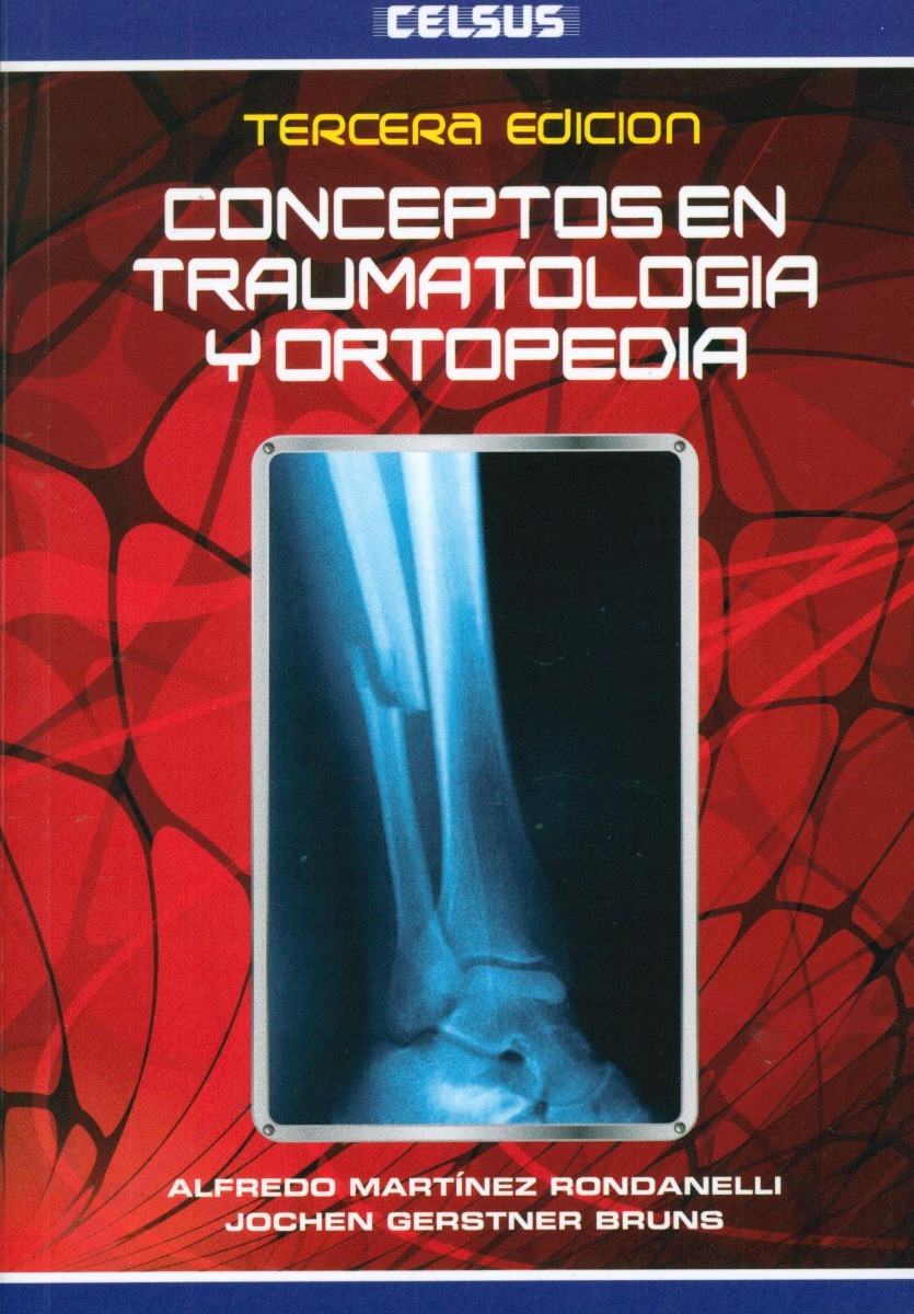 Conceptos En Traumatología Y Ortopedia (Tapa Dura)