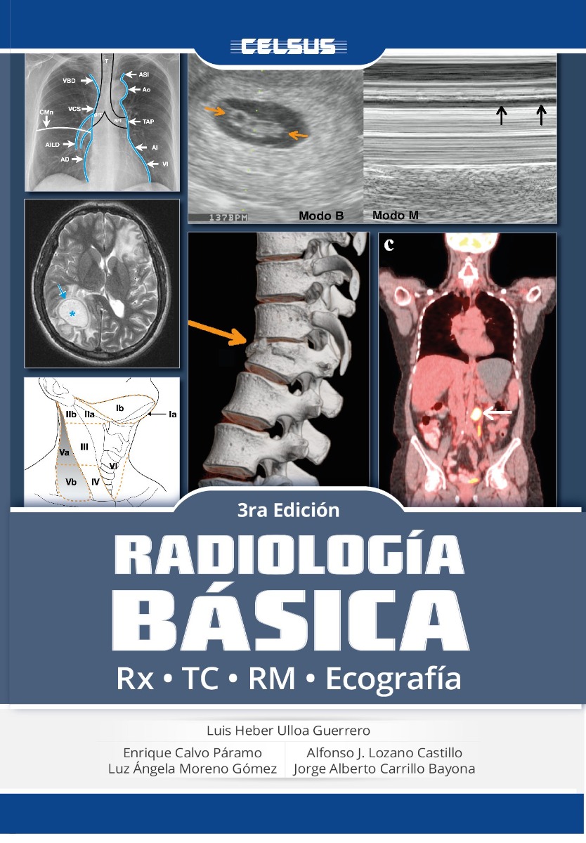 Radiología Básica Rx Tc Rm Ecografía