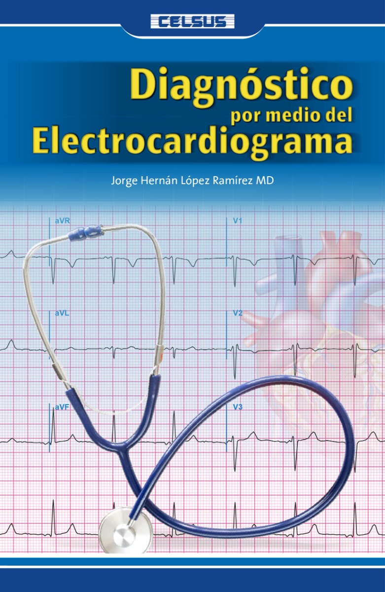 Diagnóstico por medio del Electrocardiograma