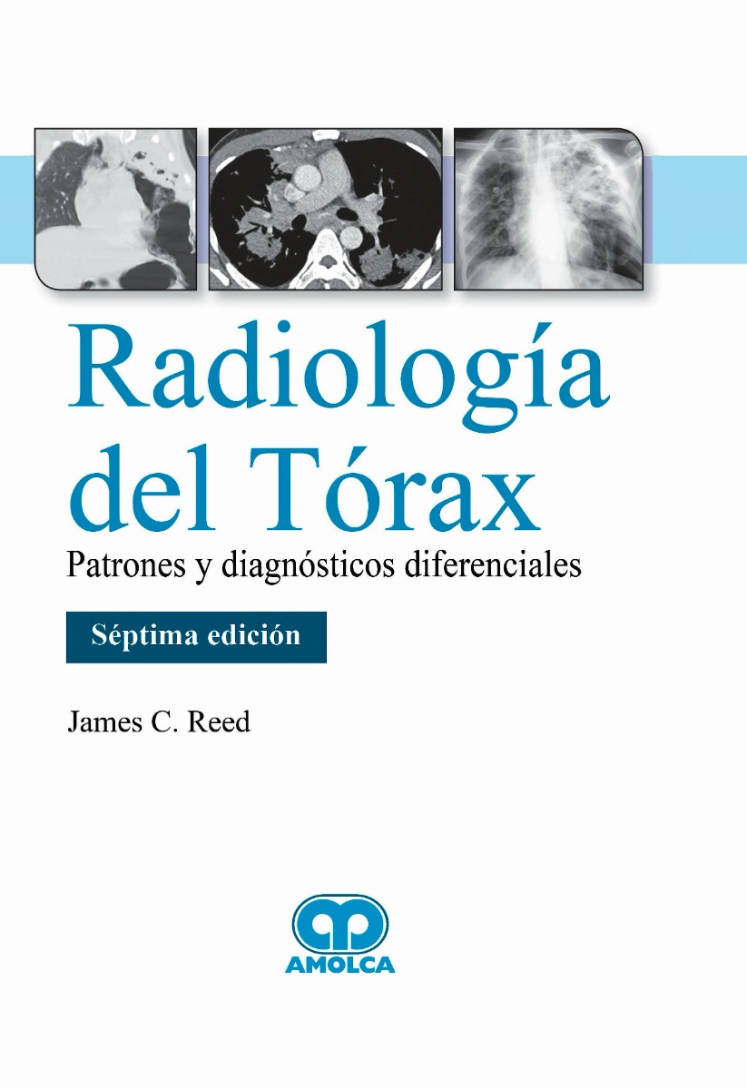 Radiología del Tórax