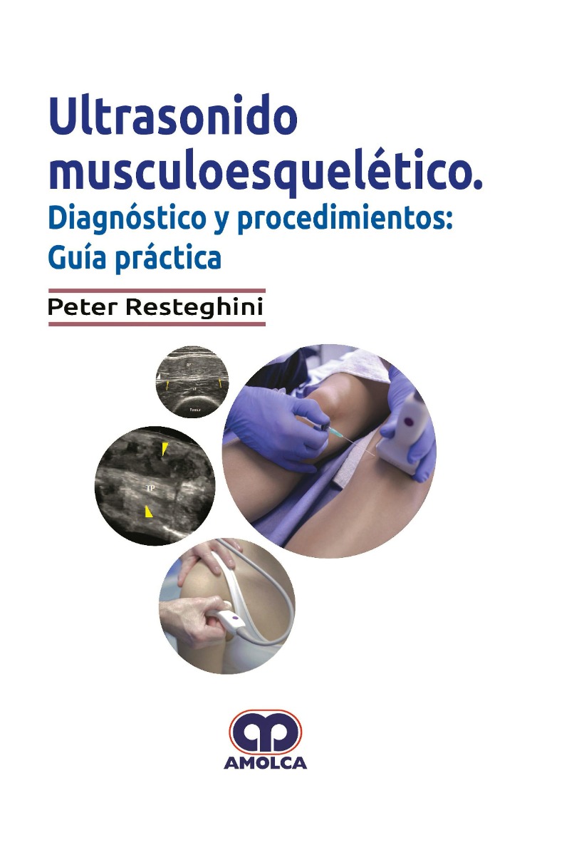 Ultrasonido Musculoesquelético. Diagnóstico y Procedimientos: Guía Práctica