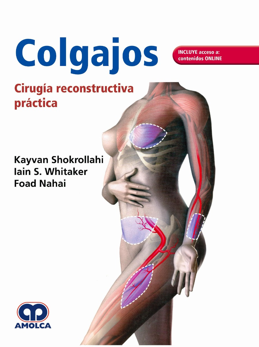 Colgajos. Cirugía Reconstructiva Práctica