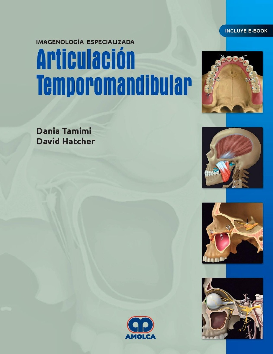 Articulación Temporomandibular