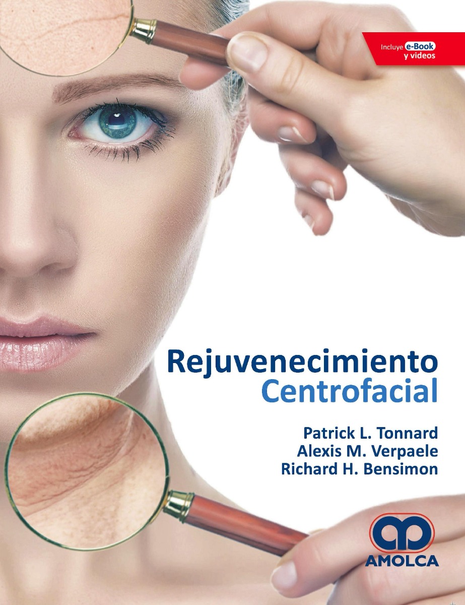 Rejuvenecimiento Centrofacial