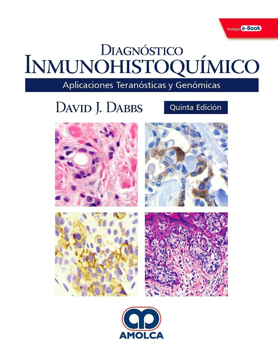 Diagnóstico Inmunohistoquímico