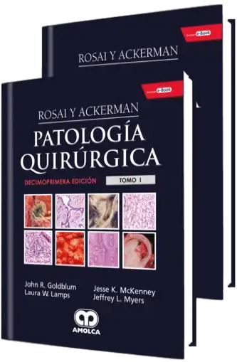 Rosai y Ackerman Patología Quirúrgica, 2 Vols.