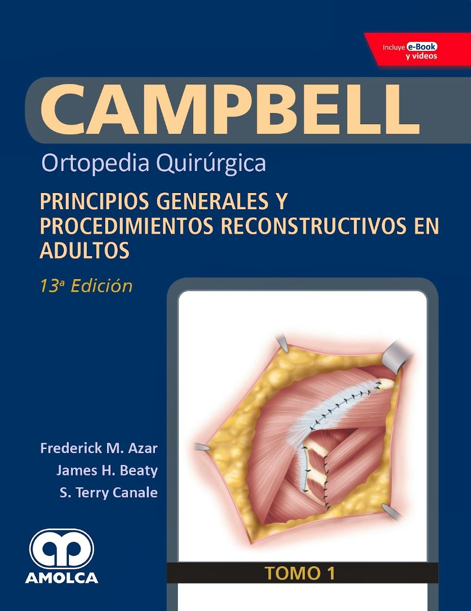 CAMPBELL Ortopedia Quirúrgica, Tomo 1: Principios Generales y Procedimientos Reconstructivos en Adultos