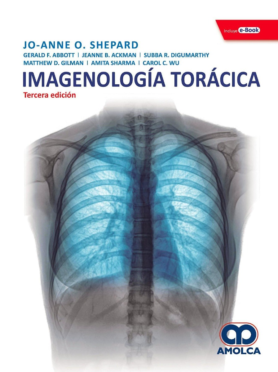 Imagenología Torácica