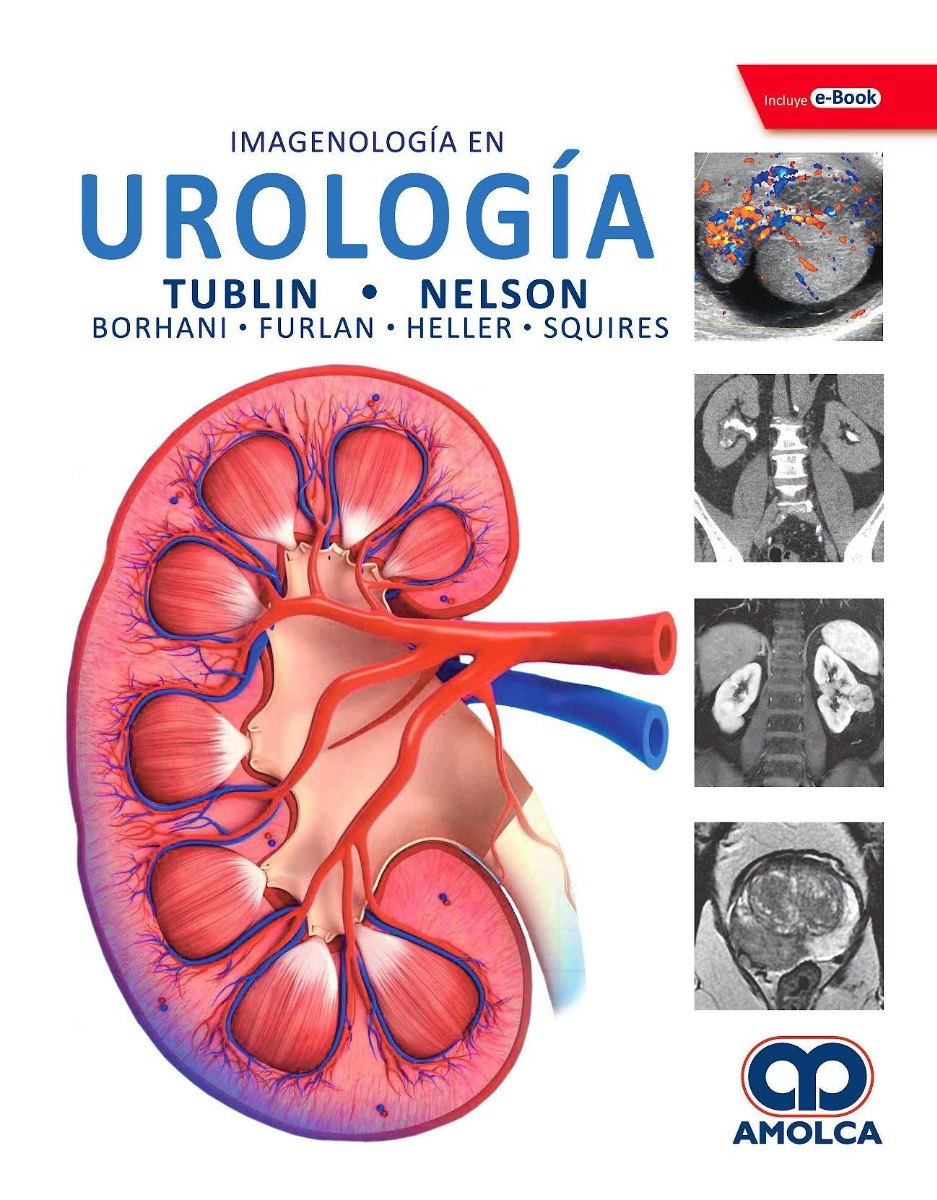 Imagenología en Urología