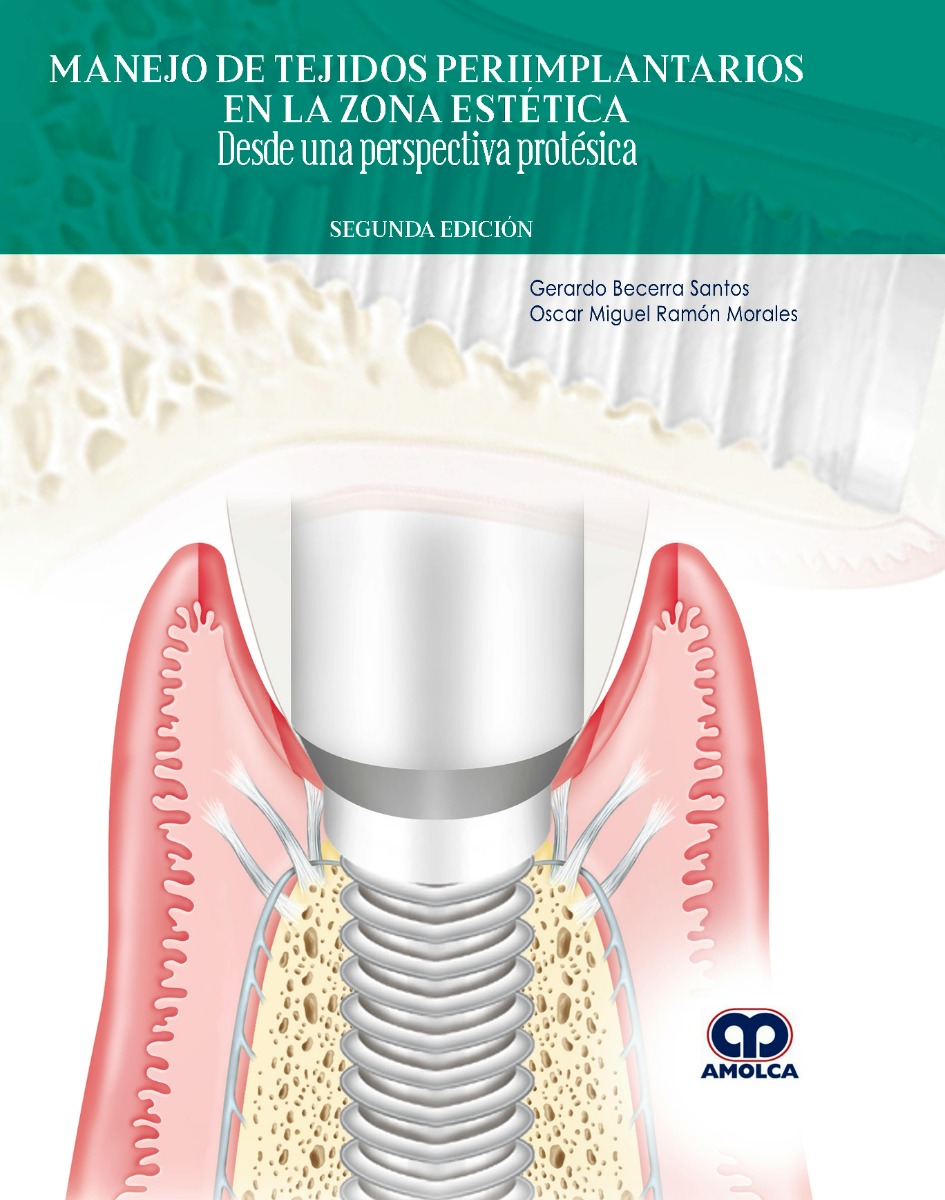 Manejo de Tejidos Periimplantarios en la Zona Estética. Desde una Perspectiva Protésica