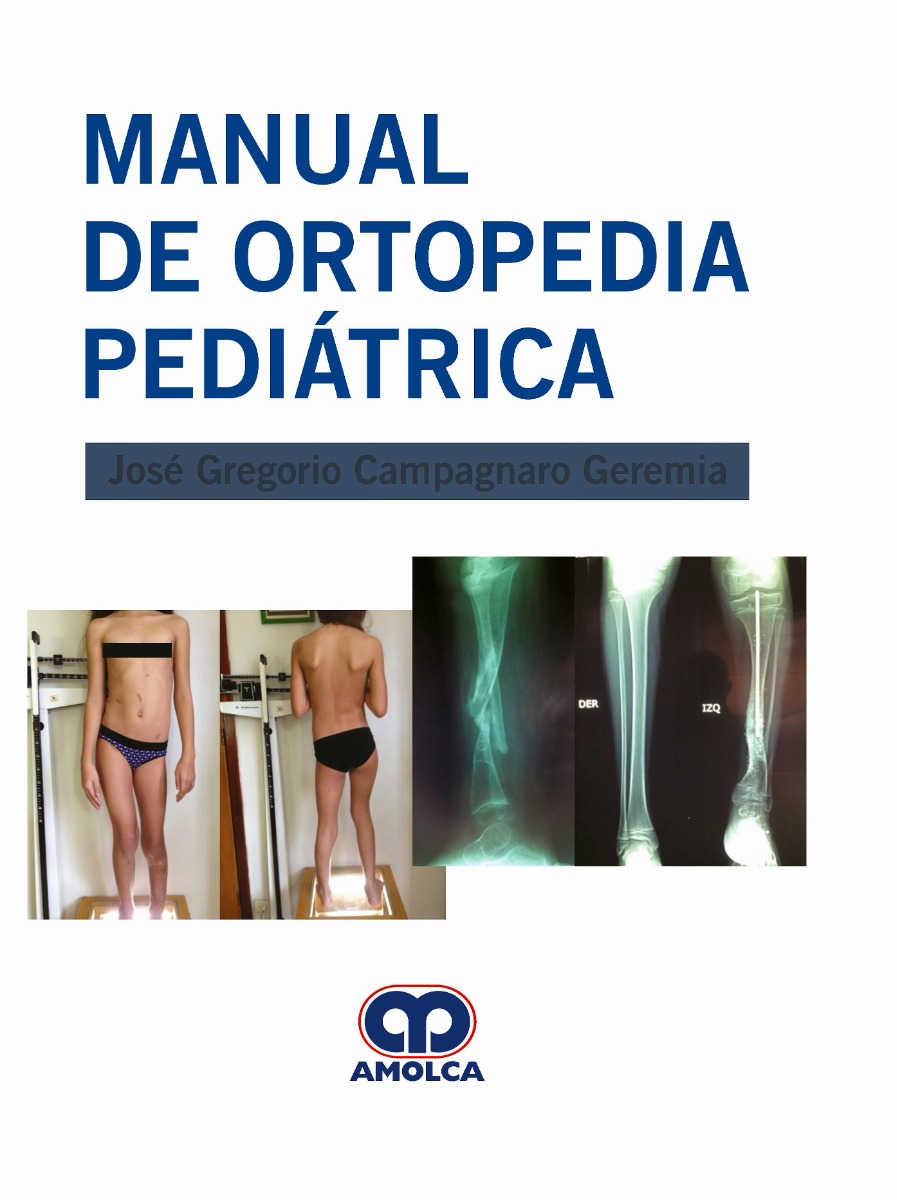 Manual de Ortopedia Pediátrica