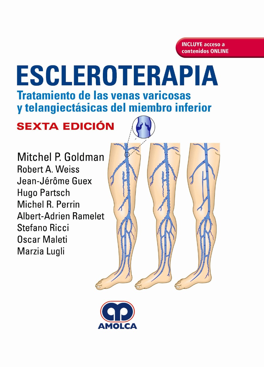 Escleroterapia