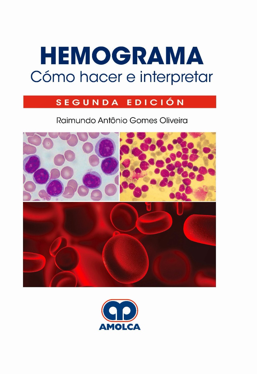 Hemograma. Cómo Hacer e Interpretar