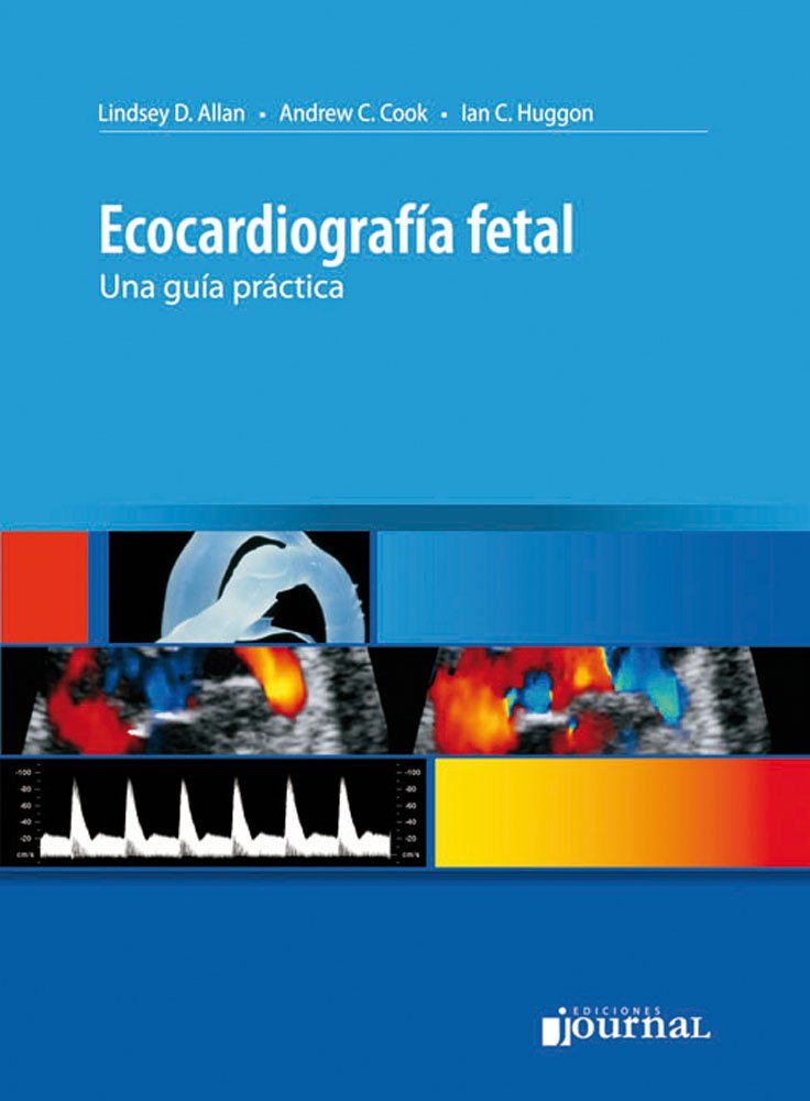 Ecocardiografía Fetal una guía practica
