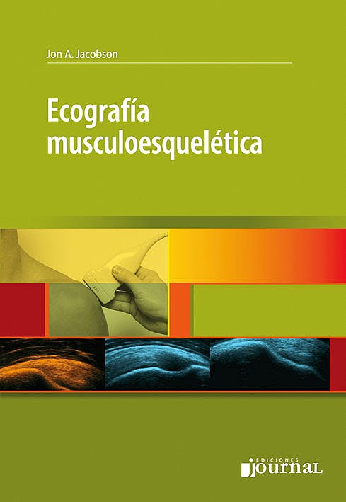 Ecografía Musculoesquelética
