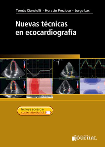 Nuevas Técnicas En Ecocardiografía