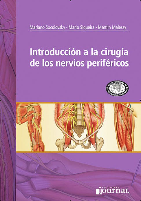 Introducción A La Cirugía De Los Nervios Periféricos