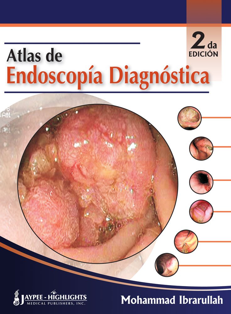 Atlas de Endoscopía Diagnóstica
