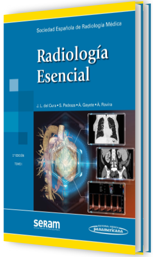 Radiología Esencial 2 Tomos