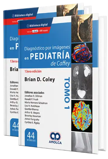 Diagnóstico por Imágenes en Pediatría 2 vol.