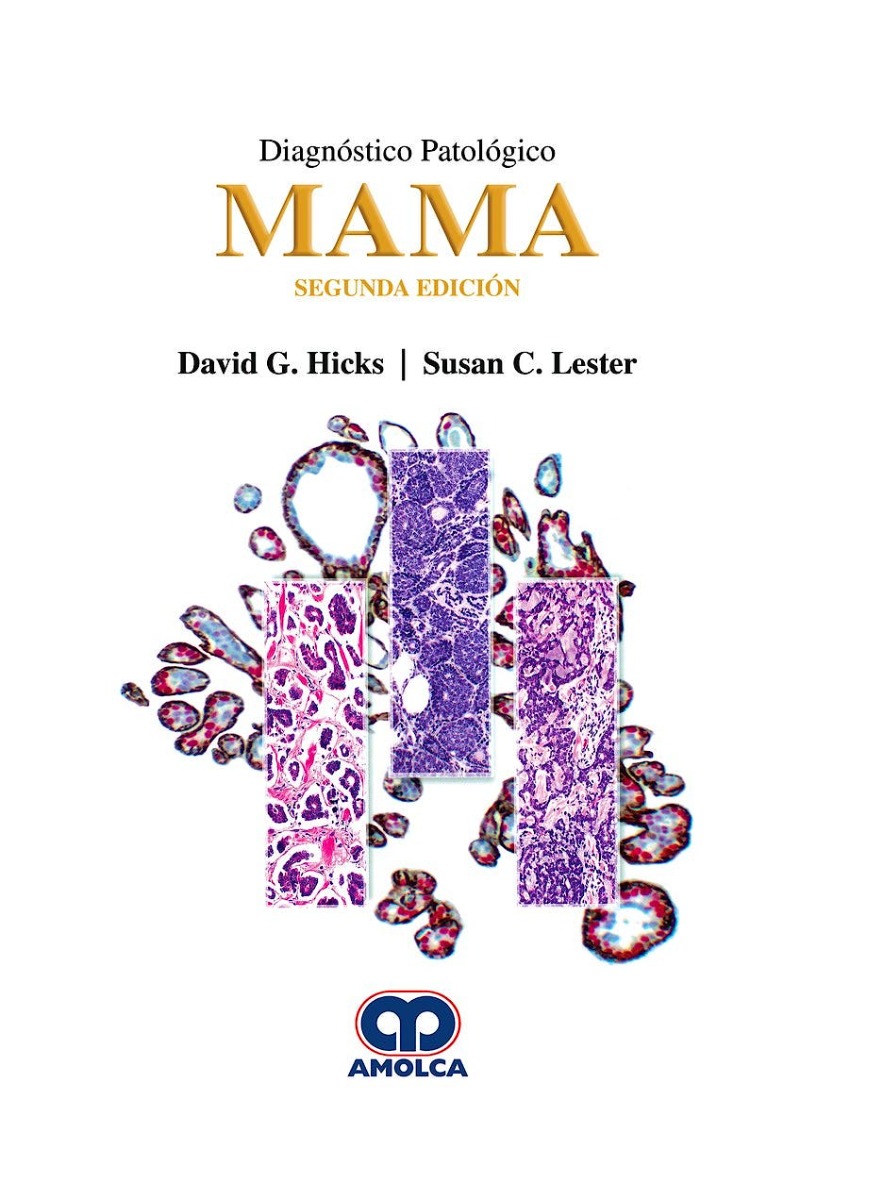 Diagnóstico Patológico. Mama