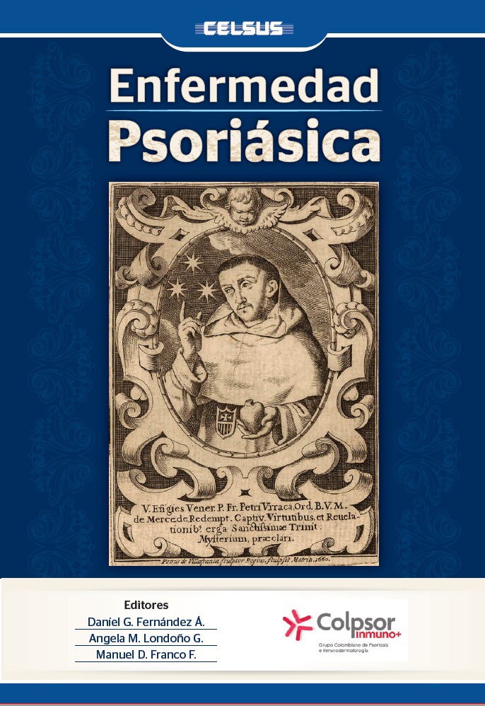 Enfermedad Psoriásica 
